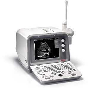CardioTech CT-60 Black & White Diagnostic Ultrasound Machine