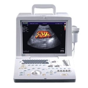 SonoScape SSI-1000 Portable Ultrasound System