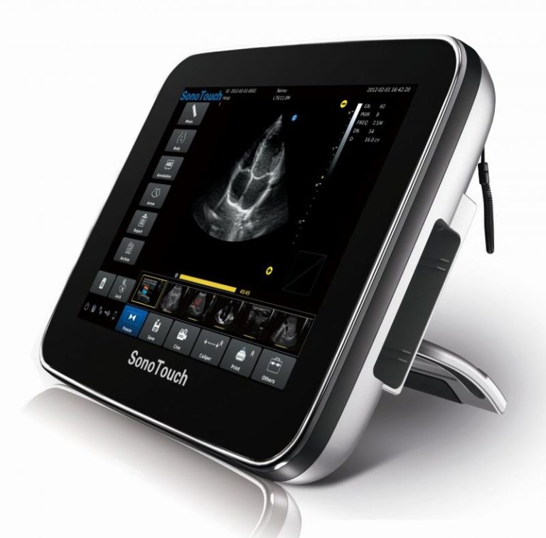 Chison SonoTouch 10 Portable Ultrasound System