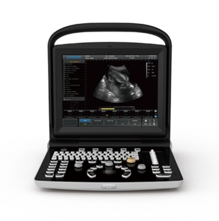 Chison ECO 3 Portable Ultrasound System