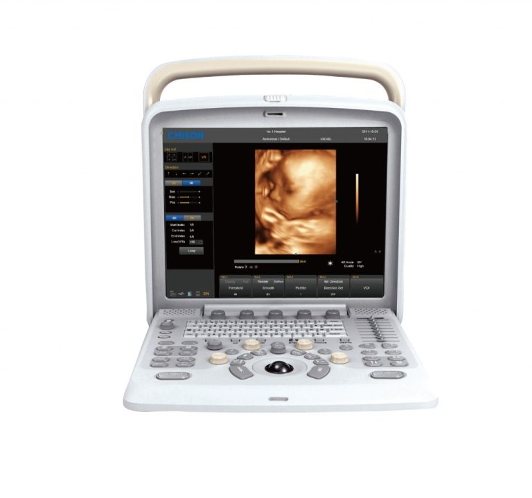 Chison Q5 Portable Ultrasound System