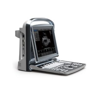 Chison ECO 1 Portable Ultrasound System