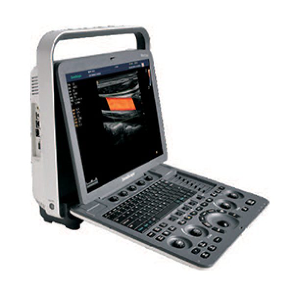 SonoScape S8 Portable Color Doppler Ultrasound System