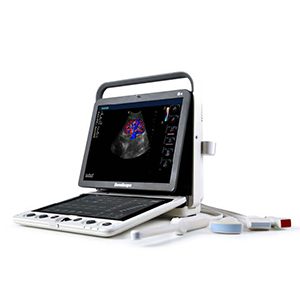 SonoScape S9 Pro Ultrasound System