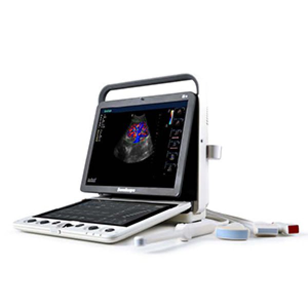 SonoScape S9 Pro Ultrasound System