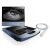 Edan Acclarix AX7 Diagnostic Ultrasound System