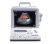SonoScape SSI-1000 Portable Ultrasound System